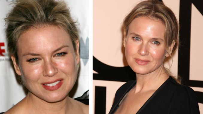 Renee Zellweger