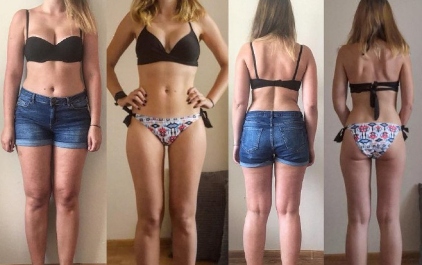 Celiulitas – neįveikiamas priešas? Lietuvaitei Agnei pavyko jo atsikratyti per 100 dienų (FOTO)